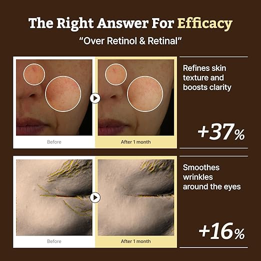 Advanced Retino-Mela Serum – HPR Retinol Serum for Face