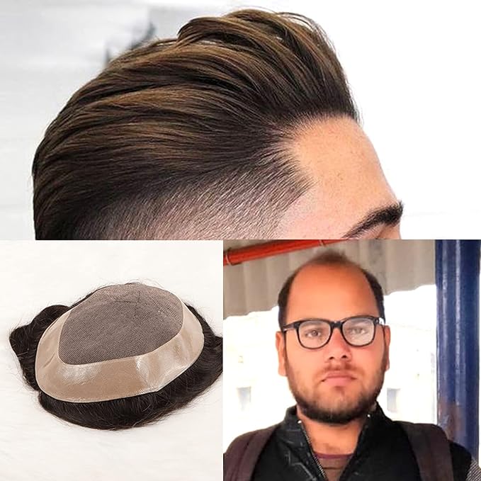Hair Patch for Men - 100% Human Hair