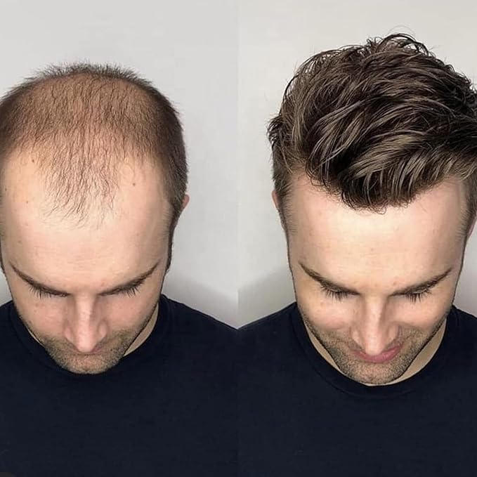 Hair Patch for Men - 100% Human Hair