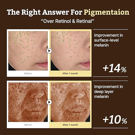 Advanced Retino-Mela Serum – HPR Retinol Serum for Face